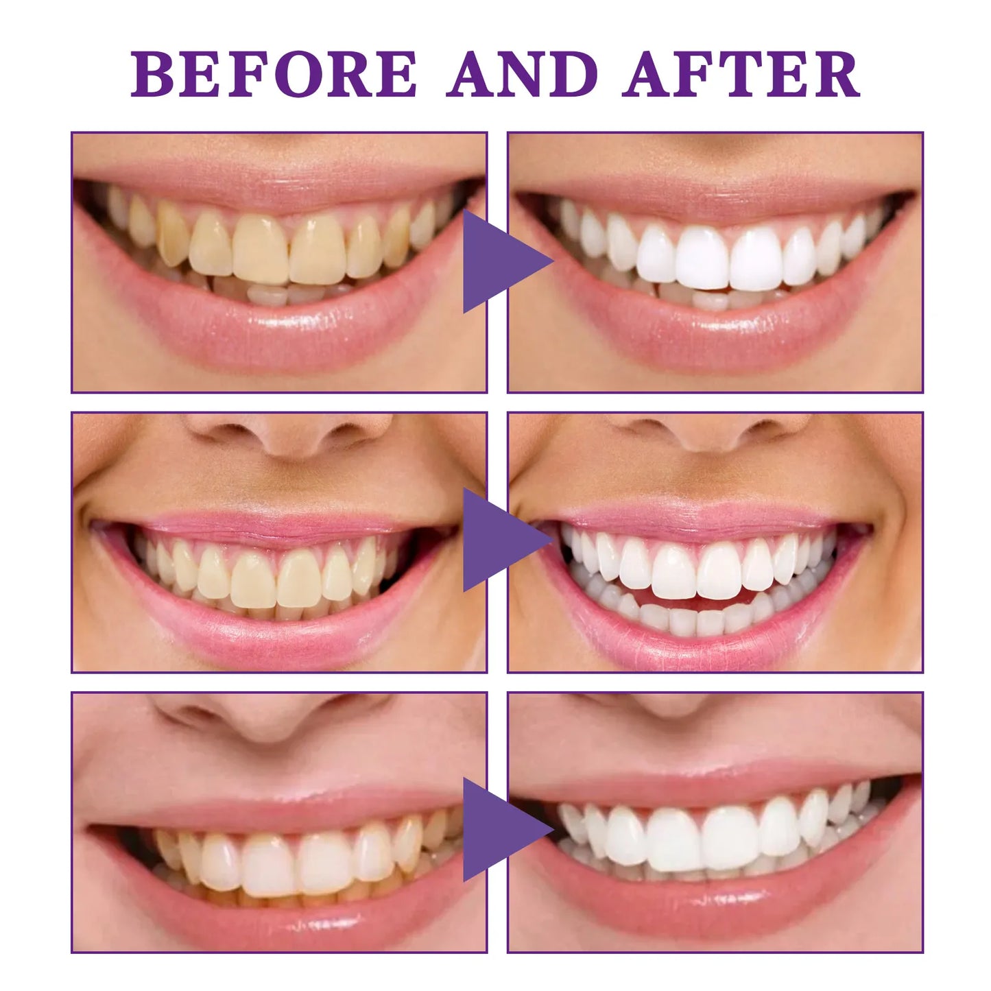Mousse Nettoyante Dents V34